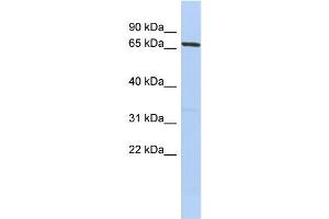 WB Suggested Anti-PRDM1 Antibody Titration:  0. (PRDM1 anticorps  (Middle Region))