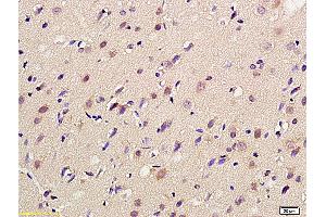 Formalin-fixed and paraffin embedded rat brain labeled with Anti-mGluR4 Polyclonal Antibody, Unconjugated (ABIN735998) at 1:200 followed by conjugation to the secondary antibody (GRM4/6 anticorps  (AA 301-400))