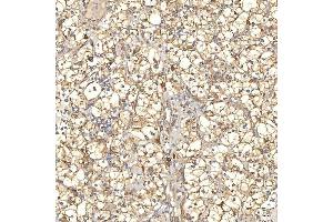 IHC analysis of TXNDC5 using anti-TXNDC5 antibody (ABIN7599699). (TXNDC5 anticorps  (AA 109-403))