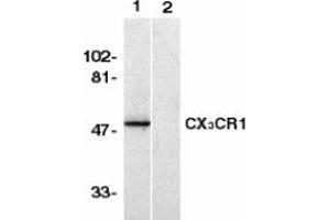Image no. 1 for anti-Chemokine (C-X3-C Motif) Receptor 1 (CX3CR1) (AA 2-21) antibody (ABIN201961) (CX3CR1 anticorps  (AA 2-21))