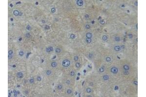 Detection of PFKP in Human Liver Tissue using Polyclonal Antibody to Phosphofructokinase, Platelet (PFKP)