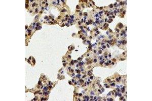 Immunohistochemical analysis of TPP2 staining in mouse lung formalin fixed paraffin embedded tissue section.