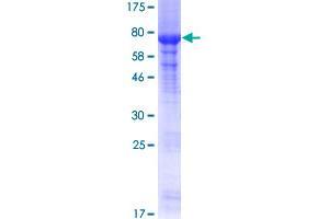 Image no. 1 for Protein Arginine Methyltransferase 2 (PRMT2) (AA 1-433) protein (GST tag) (ABIN1316329)