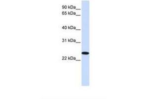 Image no. 1 for anti-Zinc Finger, DHHC-Type Containing 19 (ZDHHC19) (AA 201-250) antibody (ABIN6739187) (ZDHHC19 anticorps  (AA 201-250))