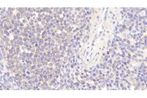 Detection of WASP in Human Spleen Tissue using Polyclonal Antibody to Wiskott Aldrich Syndrome Protein (WASP)