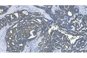 IHC analysis of EEF2/Elongation factor 2 using anti-EEF2/Elongation factor 2 antibody (ABIN7603142). (EEF2 anticorps  (N-Term))