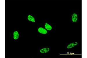 Immunofluorescence of monoclonal antibody to RBBP6 on HeLa cell.