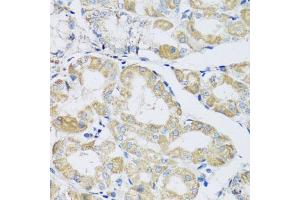 Immunohistochemistry of paraffin-embedded human stomach using ATPIF1 antibody (ABIN5972942) at dilution of 1/100 (40x lens). (ATPase Inhibitory Factor 1 anticorps)