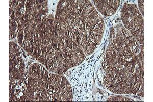 Image no. 4 for anti-Musashi Homolog 2 (MSI2) antibody (ABIN1499578)
