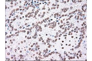 Image no. 11 for anti-Polo-Like Kinase 1 (PLK1) antibody (ABIN1500282)