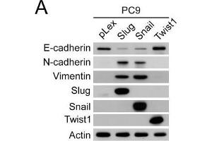 Snail- and Slug-induced EMT promoted drug resistance of parental PC9 and HCC827 cells. (TWIST1 anticorps  (Center))