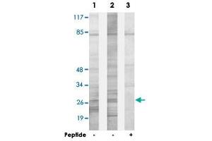 Western blot analysis of extracts from HepG2 cells (Lane 1) and HeLa cells (Lane 2 and lane 3), using SPIC polyclonal antibody . (SPIC anticorps)