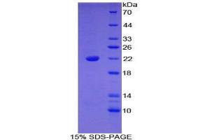 SDS-PAGE analysis of Mouse Bleomycin Hydrolase Protein. (BLMH Protéine)