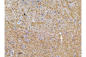 ABIN7094481 and ABIN7098530 at 1/100 staining rat brain tissue by IHC-P. (PLP1 anticorps  (Internal Region))
