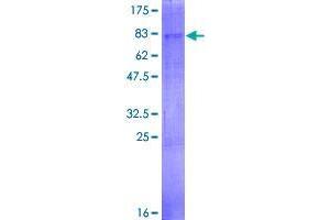 Image no. 1 for 1-Acylglycerol-3-Phosphate O-Acyltransferase 6 (Lysophosphatidic Acid Acyltransferase, Zeta) (AGPAT6) (AA 1-456) protein (GST tag) (ABIN1344587)