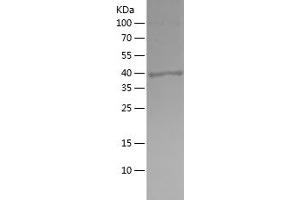 Western Blotting (WB) image for Amphiregulin (AREG) (AA 101-198) protein (His-IF2DI Tag) (ABIN7121818) (Amphiregulin Protein (AREG) (AA 101-198) (His-IF2DI Tag))