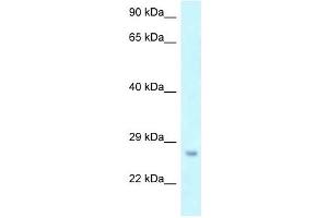 Western Blot showing OSTF1 antibody used at a concentration of 1 ug/ml against THP-1 Cell Lysate (OSTF1 anticorps  (N-Term))