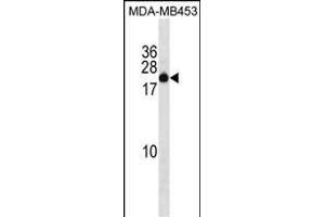 ZN Antibody (C-term) (ABIN1536745 and ABIN2850068) western blot analysis in MDA-M cell line lysates (35 μg/lane). (ZNF747 anticorps  (C-Term))