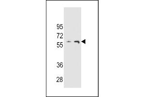 THUM3 Antibody (Center) (ABIN654774 and ABIN2844455) western blot analysis in  and  cell line lysates (35 μg/lane). (THUMPD3 anticorps  (AA 194-223))