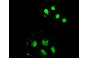 Image no. 16 for anti-Sjogren Syndrome Antigen B (SSB) antibody (ABIN1501146) (SSB anticorps)