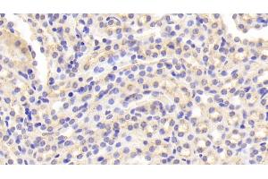 Detection of CTSD in Mouse Kidney Tissue using Polyclonal Antibody to Cathepsin D (CTSD) (Cathepsin D anticorps  (AA 66-410))
