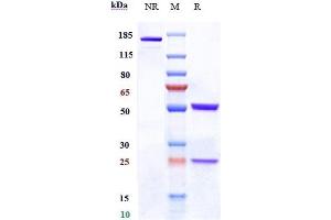 Anti-CD19 Reference Antibody (denintuzumab) on SDS-PAGE under reducing (R) condition.