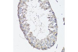 Immunohistochemistry of paraffin-embedded mouse testis using MRP4/ antibody (ABIN3023192, ABIN3023193, ABIN3023194 and ABIN6219432) at dilution of 1:150 (40x lens). (ABCC4 anticorps  (AA 495-705))