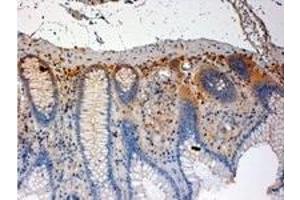 Image no. 3 for anti-C-Src tyrosine Kinase (CSK) (C-Term) antibody (ABIN374096) (CSK anticorps  (C-Term))
