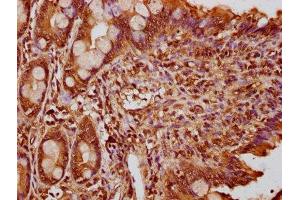 IHC image of ABIN7165594 diluted at 1:300 and staining in paraffin-embedded human small intestine tissue performed on a Leica BondTM system.