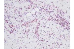 Image no. 3 for anti-Melanoma Inhibitory Activity (MIA) antibody (ABIN464851) (MIA anticorps)