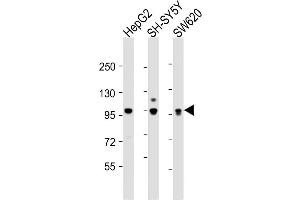 Western Blot at 1:2000 dilution Lane 1: HepG2 whole cell lysate Lane 2: SH-SY5Y whole cell lysate Lane 3: SW620 whole cell lysate Lysates/proteins at 20 ug per lane.