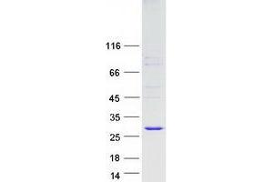 Validation with Western Blot