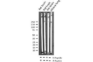 Western blot analysis of Phospho-ACC1 (Ser80) expression in various lysates