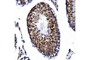 IHC analysis of PRDM14 using anti-PRDM14 antibody (ABIN7603152).
