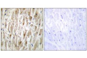 Immunohistochemistry analysis of paraffin-embedded human heart tissue using LIMK2 antibody. (LIMK2 anticorps  (Internal Region))