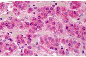 Human Adrenal: Formalin-Fixed, Paraffin-Embedded (FFPE) (SMAD3 anticorps  (AA 100-150))