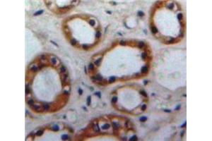 Used in DAB staining on fromalin fixed paraffin-embedded Kidney tissue