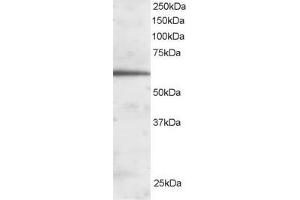 ABIN185022 staining (1µg/ml) of Human Liver lysate (RIPA buffer, 30µg total protein per lane). (FOXA2 anticorps  (C-Term))
