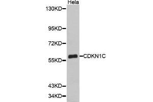 Western Blotting (WB) image for anti-Cyclin-Dependent Kinase Inhibitor 1C (p57, Kip2) (CDKN1C) (AA 1-100) antibody (ABIN3022819)
