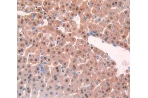 IHC-P analysis of liver tissue, with DAB staining. (TNFRSF1A anticorps  (AA 239-433))