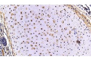 Detection of FMOD in Porcine Lung Tissue using Polyclonal Antibody to Fibromodulin (FMOD)