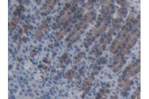 Detection of ABCC11 in Rat Stomach Tissue using Polyclonal Antibody to ATP Binding Cassette Transporter C11 (ABCC11)