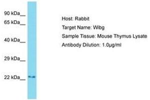 Image no. 1 for anti-Partner of Y14 and mago (WIBG) (AA 81-130) antibody (ABIN6750448) (PYM anticorps  (AA 81-130))