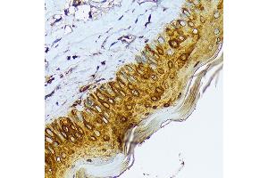 Immunohistochemistry of paraffin-embedded mouse skin using Cytokeratin 1 (KRT1) (KRT1) Rabbit mAb (ABIN7268085) at dilution of 1:100 (40x lens). (Cytokeratin 1 anticorps)