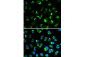 Immunofluorescence analysis of HepG2 cell using SHMT2 antibody. (SHMT2 anticorps)