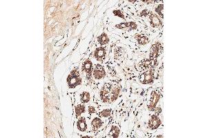 Immunohistochemical analysis of paraffin-embedded human breast tissue using C performed on the Leica® BOND RXm. (ALOXE3 anticorps  (AA 223-252))
