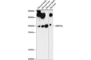 Western blot analysis of extracts of various cell lines, using SRD5 antibody (4787) at 1:1000 dilution.