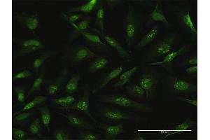 Immunofluorescence of purified MaxPab antibody to CDC6 on HeLa cell. (CDC6 anticorps  (AA 1-560))