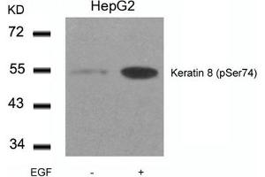 Western blot analysis of extracts from HepG2 cells untreated or treated with EGF using Keratin 8(Phospho-Ser74) Antibody. (KRT8 anticorps  (pSer74))