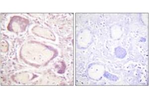 Immunohistochemistry analysis of paraffin-embedded human placenta, using Cyclin B1 (Phospho-Ser147) Antibody.